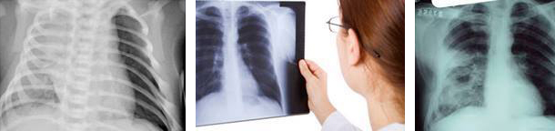 Foto Fisiopatologia